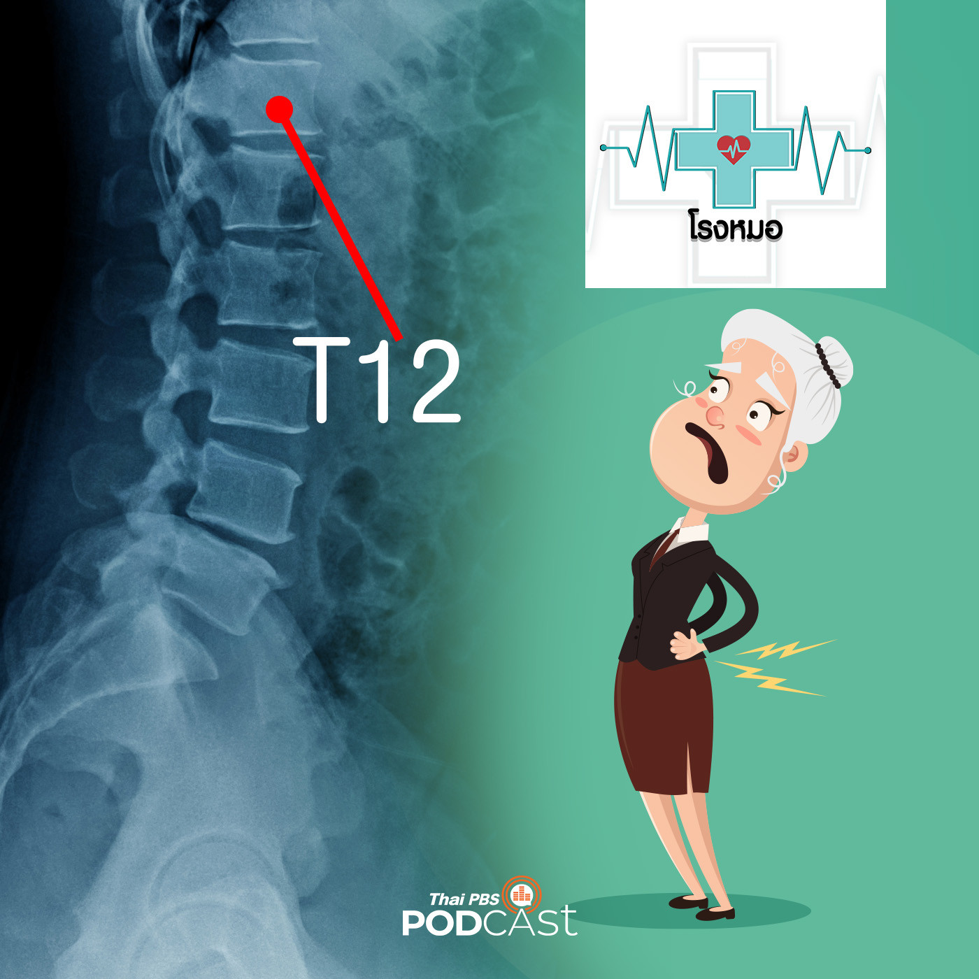 โรงหมอ EP. 632: พลัตตกจากที่สูง ระวังกระดูกสันหลังหัก