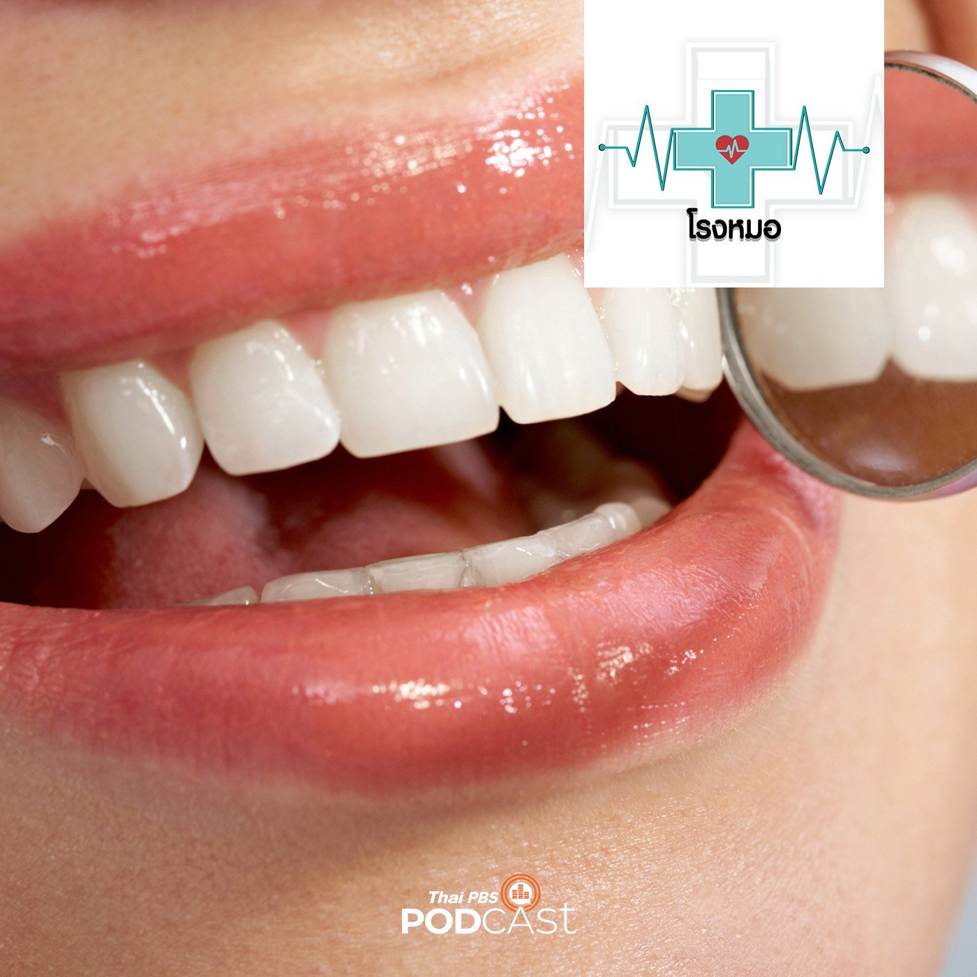 โรงหมอ EP. 861: ฟอกฟันสีขาว ความเสี่ยงและอันตรายที่อาจเกิดขึ้น