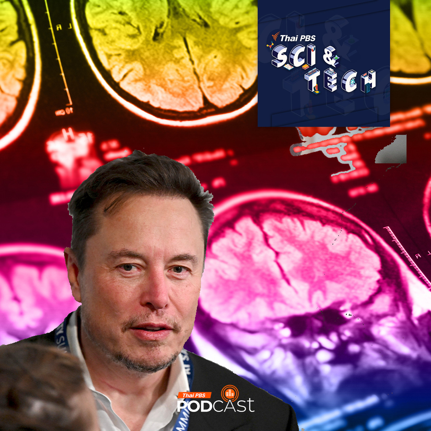 Sci & Tech EP. 794: Neuralink ทดสอบฝังชิปกับสมองมนุษย์คนแรก